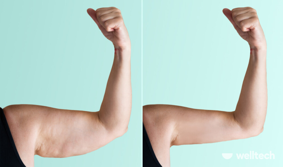 Exercises for flabby arms over 60, older women bingo wings to toned arms