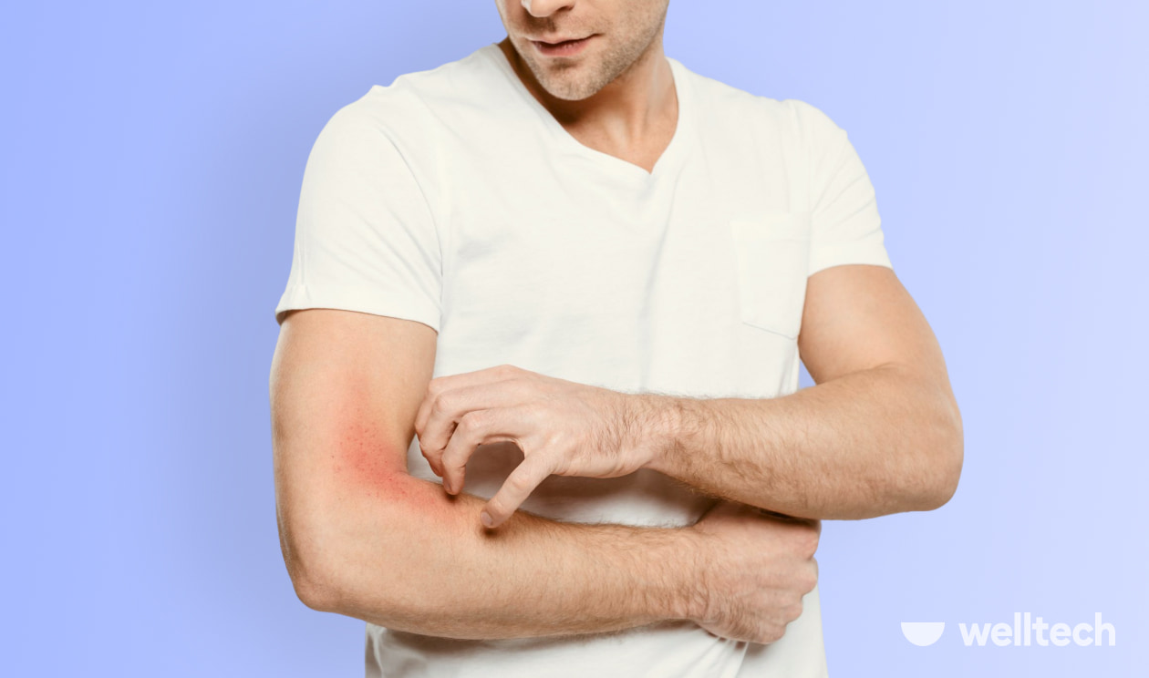 a man in a white t-shirt is scratching his hand due to itching_why does pre-workout make you itch