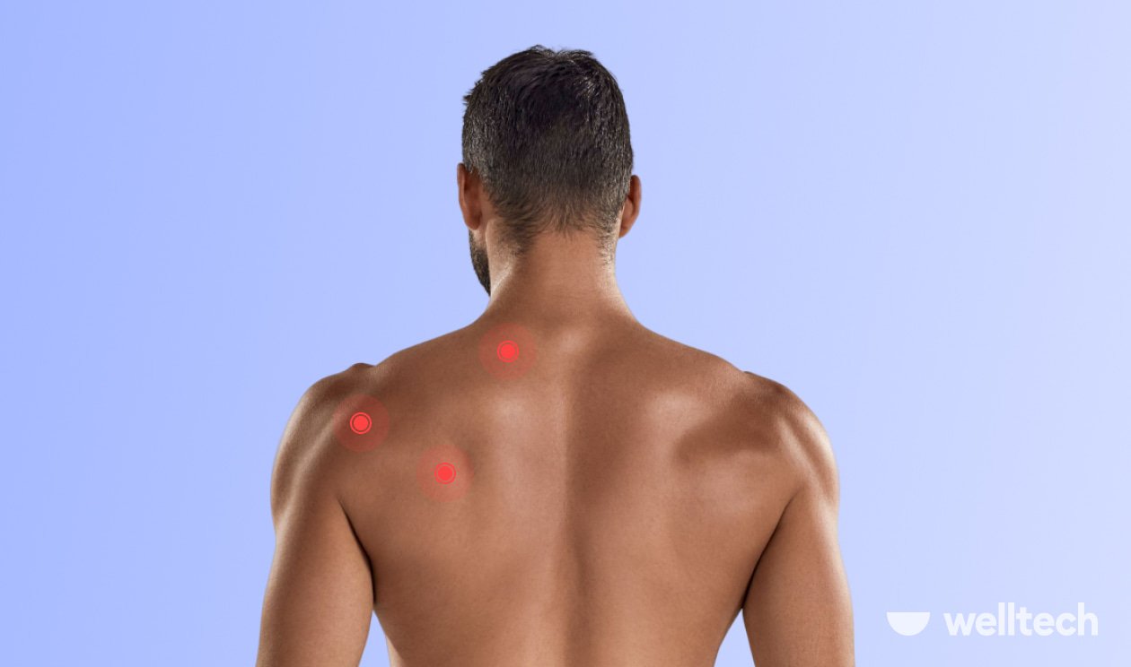 a man is standing with his back with red dots on his back illustrating muscle knots, what does a muscle knot feel like
