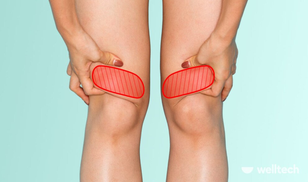 female legs, knee area, fat above the knees highlighted in red, knee fat exercises