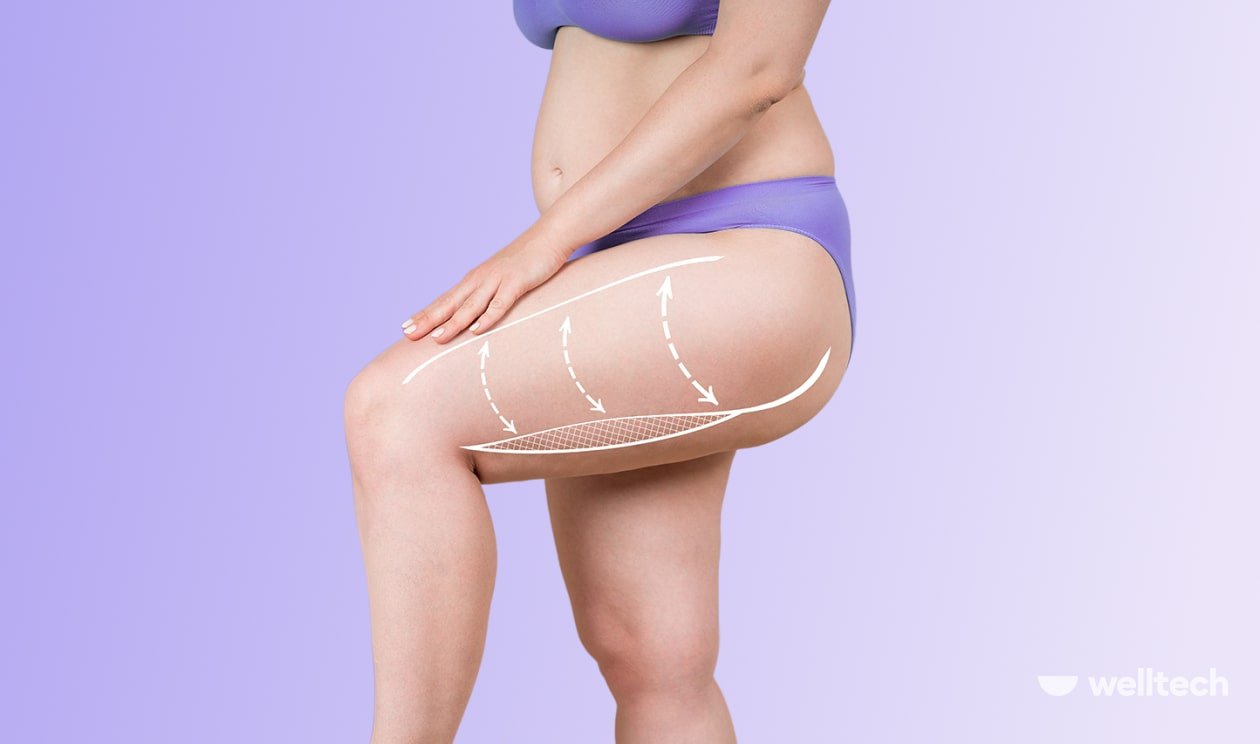 a woman in a purple underwear set, overweight, showing her thighs, how to lose weight in thighs and butt